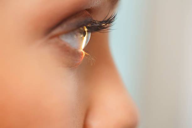 Iris Shots Lightening