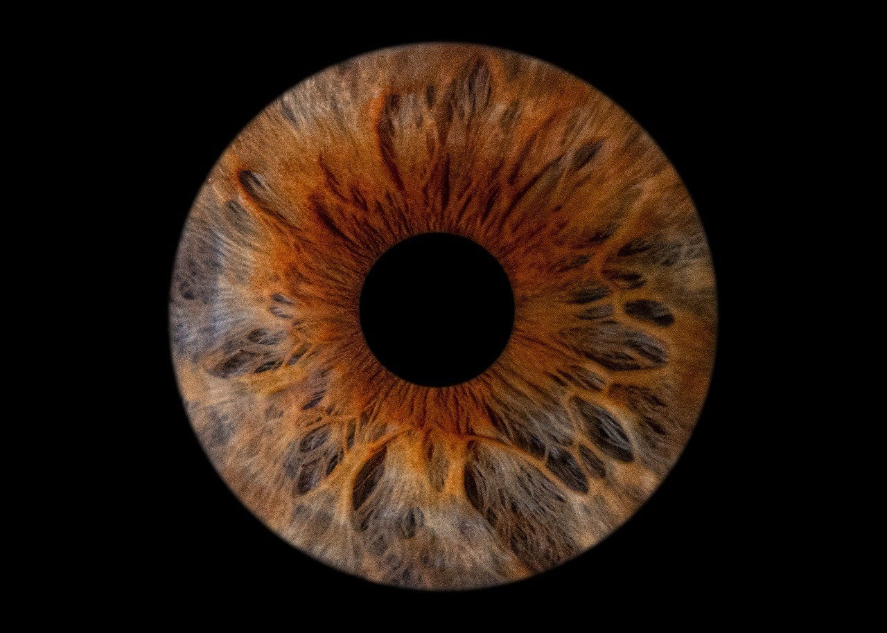 Iris eye