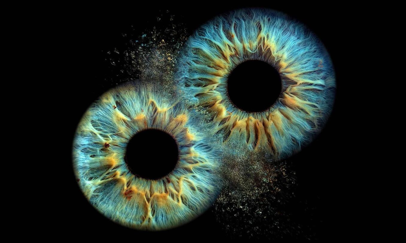 Pictures of Irises Eyes