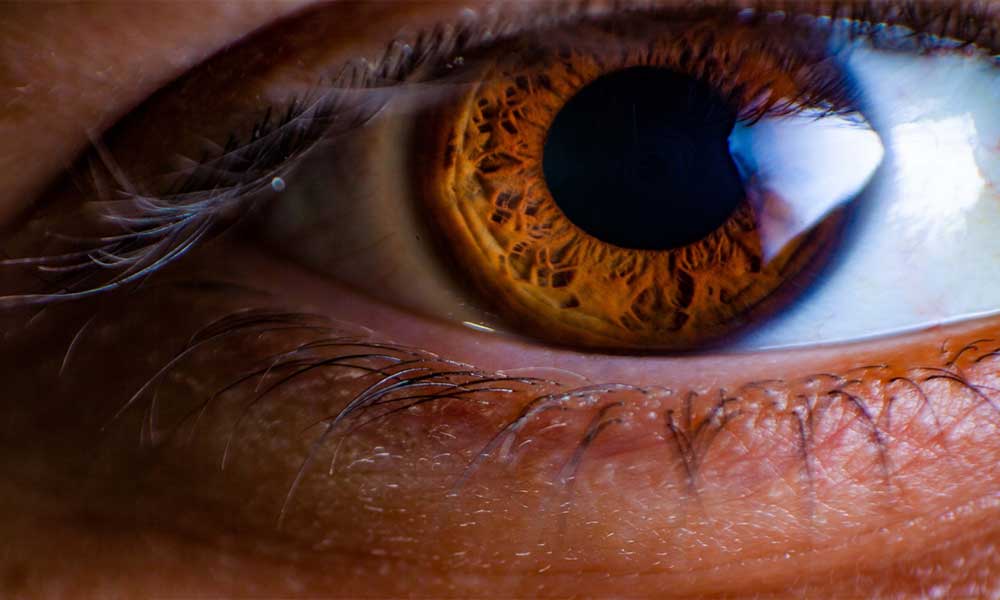 What is iridology?