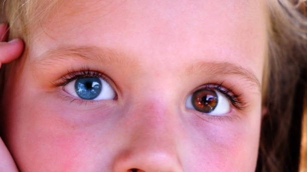 Most Unique Eye Color In The World
