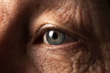 Old Person Eye