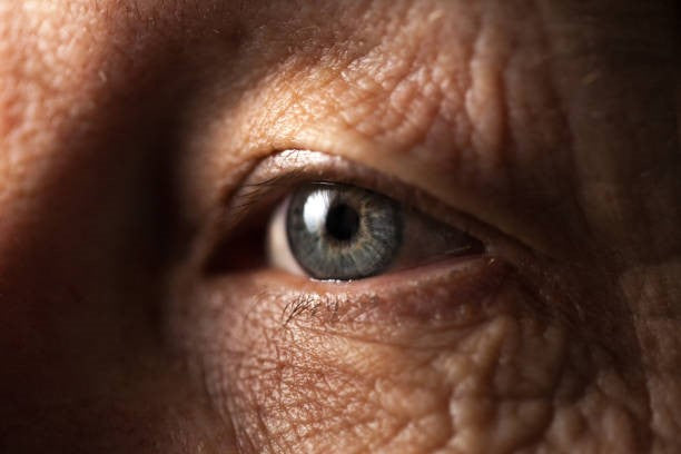 Old Person Eye