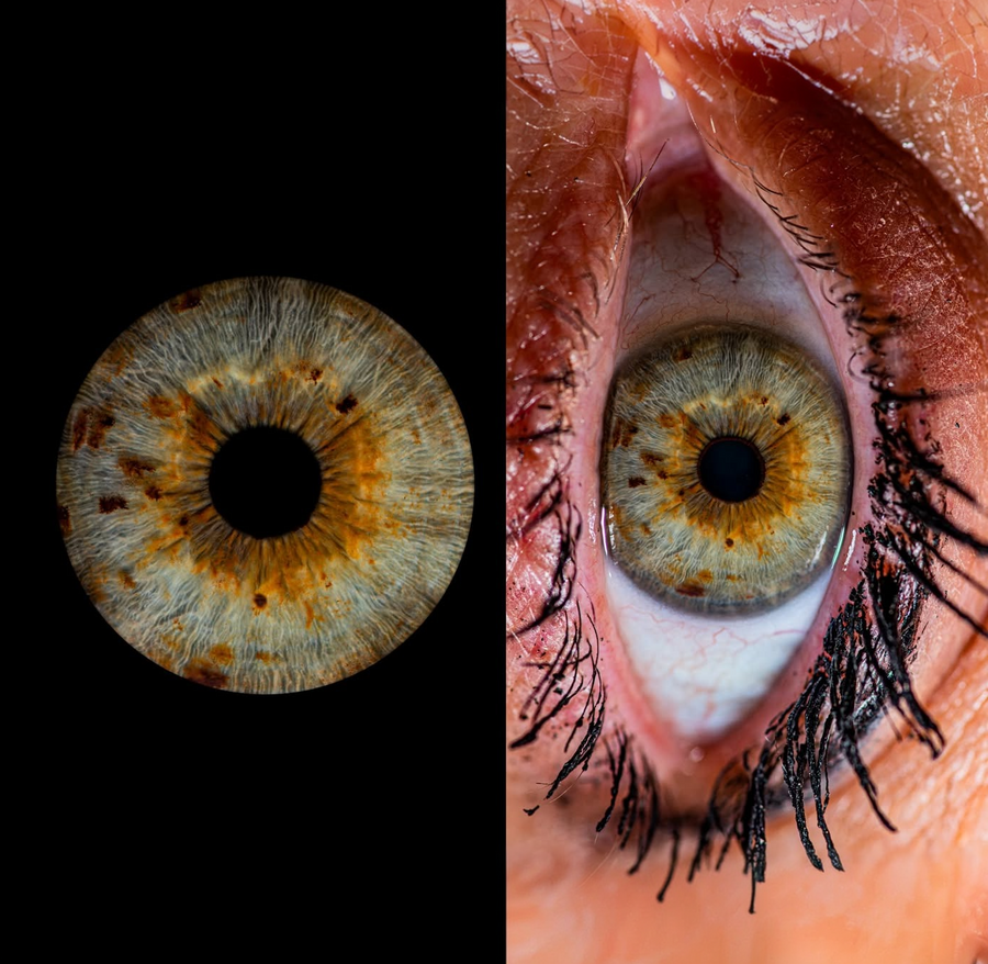 YOUR EYE